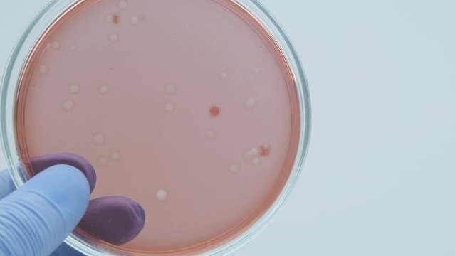 Bacteria culture growth on a petri dish in microbiology lab. Candida auris. Closeup of bacteria culture growth on selective media plate in microbiology laboratory. Biomarker. Bio-reagent.