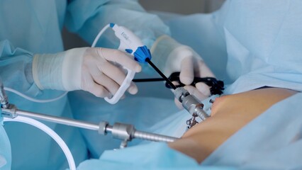 Hands of surgeons with the help of endoscopic equipment and instruments operate. performing...