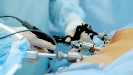 Hands of surgeons with the help of endoscopic equipment and instruments operate. performing...