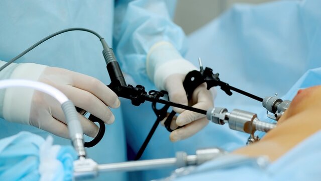 Hands of surgeons with the help of endoscopic equipment and instruments operate. performing laparoscopic surgery using endoscopic and laparoscopic instruments. laparoscopic instrument. 
