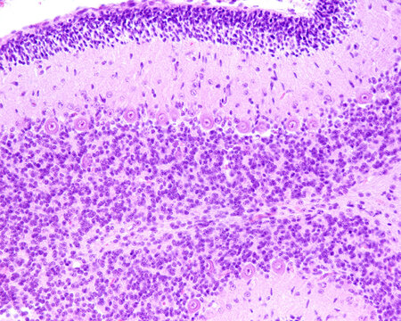 Immature cerebellum. External granular layer