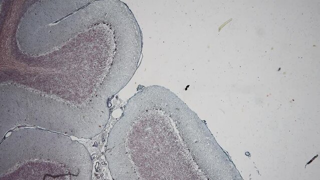 Histological Cerebellum human And Spinal cord human under the microscope for education.