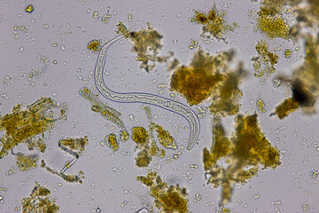 Finding Trichuris trichiura egg and Strongyloides egg in the feces under the microscope in Lab.