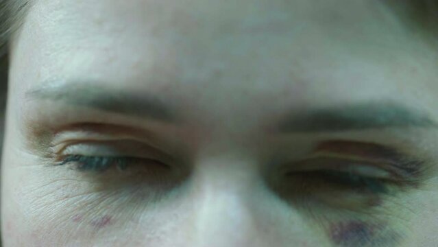 Close up female black eyes after domestic abuse