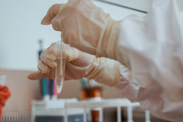 Nasal swab laboratory test in hospital lab, Nurse holding test tube for 2019-nCoV analyzing.
