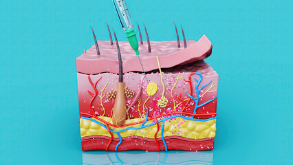Abstract illustration of a subcutaneous injection