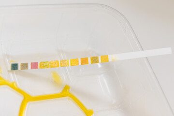 urine sample with test strip waiting for evaluation