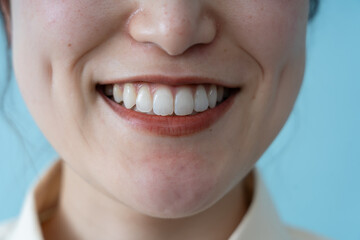 歯並びの良い女性の口モトの写真