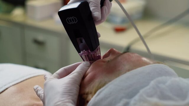 A cosmetologist performs microneedle lifting on a senior woman. Facial skin tightening beauty procedures by a professional. High quality 4k footage