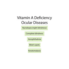 Diagram showing Vitamin A deficiency related ocular diseases - keratomalcia, xerophthalmia, night blindness, bitot's spots - simplified schematic diagram.