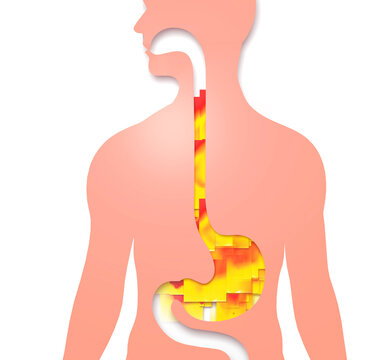 recommend clip art: 3d illustration of esophagus with gastric reflux and heartburn. With flat squares of fire moving upwards. Digestive system and human silhouette on white background.