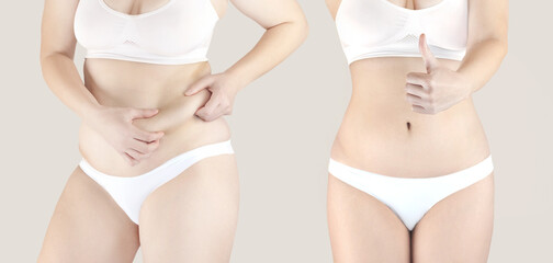 Collage of 2 female figures in white underwear. Woman Before and after losing weight. Overweight...