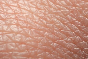 Fototapeta premium Texture of dry skin as background, macro view