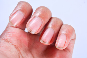 Close up of a woman’s dirty hands and fingernails after gardening