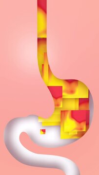 3d animation of stomach with rectangles of fire inside. Moving up. Burning and reflux. Human digestive system on white background.