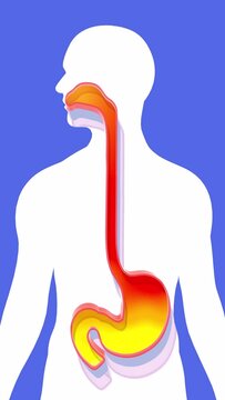 3d animation of stomach and esophagus to the mouth with fire. Reflux and indigestion. Showing the digestive system in relief on cutout human silhouette on blue background.