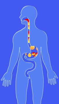 3d animation of esophagus and stomach with gastric reflux and burning. With circles of fire moving upward. Digestive system and human silhouette made of transparent glass on a blue background.