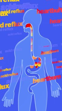 3d animation of esophagus and stomach with gastric reflux and burning. Featuring circles of fire and the words "acid reflux" and "heartburn" moving upwards. Transparent glass digestive system on blue 