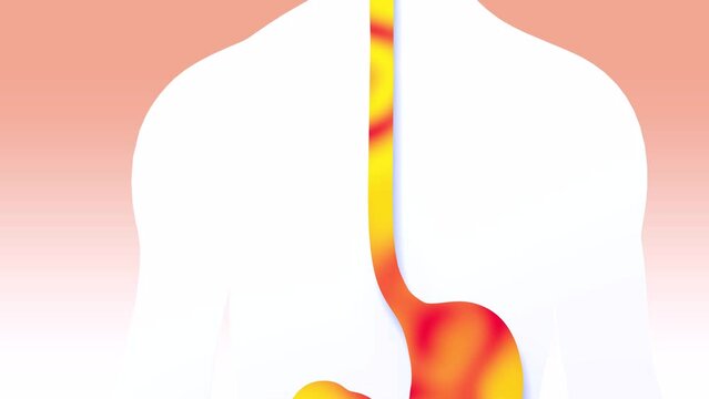 3d animation of fire digestive system over human silhouette. Esophagus with gastric reflux and heartburn.