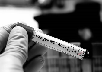 Blood sample of patient positive tested for dengue NS1 Ag.