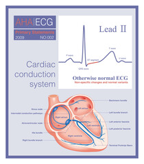 Sometimes, there may be slight non-specific changes and normal variations in the electrocardiogram, which are often due to physiological reasons and have no clinical therapeutic significance.
