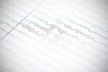 Closeup eclectroencephalogram graph on paper, epilepsy diagnosis