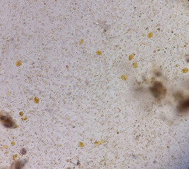 Giardia lamblia cysts and Trophozoite form, muscle fiber in stool examination, under 40X light microscope, selective focus.