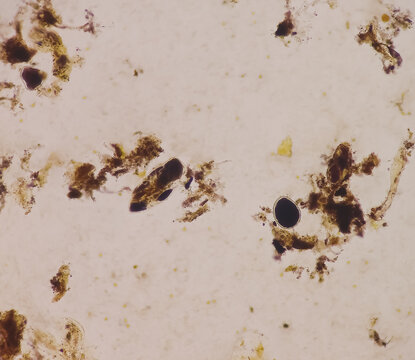 Giardia lamblia cysts and Trophozoite form, muscle fiber in stool examination, under 40X light microscope, selective focus.