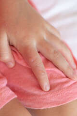 coxsackievirus, Singapore flu, skin rashes, blisters, viral infection, disease