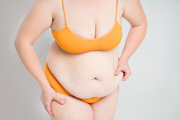 Tummy tuck, flabby skin with stretch marks on a fat belly, plastic surgery concept on gray background - 745106323