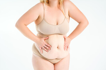 Tummy tuck, flabby skin with stretch marks on a fat belly, plastic surgery concept on gray background - 745106386