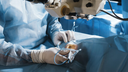 Open eye. Patient under sterile cover. Close-up. Laser vision correction. Patient and surgeon in...