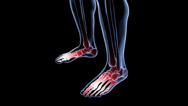 Medical Rendering of Foot pain on Human Male Skeleton in X-ray render