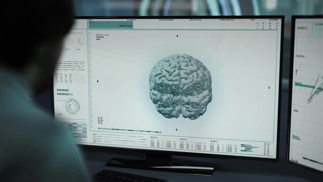 A Doctor is performing the examination of the patient. The Examination system is studying the 3D Projected brain of the patient. An examination has found the tumor inside the patient`s brain. UI.