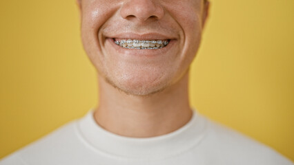 Casual young hispanic teenager radiates joy, confidently flashing his orthodontic braces while...