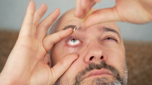 Man applying eye drop for optical symptoms. Eye drops, eye care and medicine in medical treatment. Tired eyes, irritation and allergies relief. Male with vision problems, nearsightedness, eyelids
