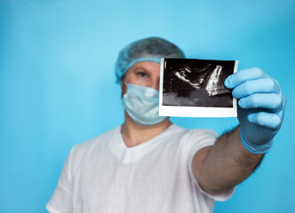 A surgeon examines an ultrasound of a prostate adenoma in a man. A urologist studies a disease of...