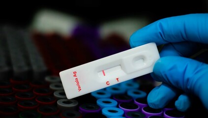 Blood sample of patient negative tested for variola virus by rapid diagnostic test.