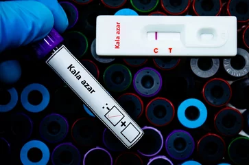 Photo sur Plexiglas Atlantic Ocean Road Blood sample of patient negative tested for kala azar by rapid diagnostic test