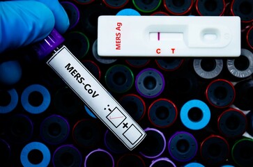 alaskaBlood sample of patient negative tested for MERS-CoV by rapid diagnostic test
