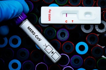 Fototapeta premium alaskaBlood sample of patient negative tested for MERS-CoV by rapid diagnostic test