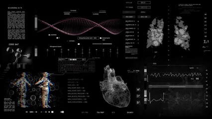 A computer screen displaying an image of a human body and heart on it