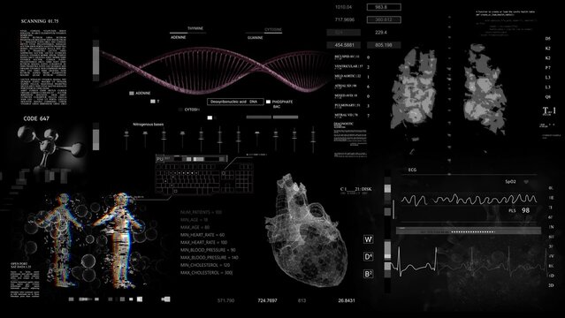 A computer screen displaying an image of a human body and heart on it