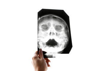 X-ray of the head. Fluorography of maxillary sinuses. Concept of medicine