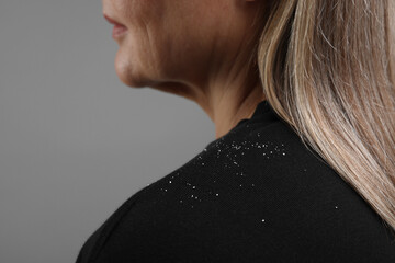 Woman with dandruff on her sweater against gray background, closeup