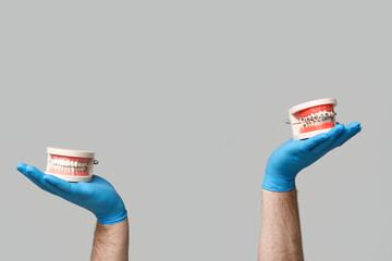 Dentist hands with jaw models on grey background. World Dentist Day