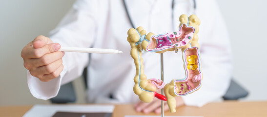 Doctor with human Colon anatomy model. Colonic disease, Large Intestine, Colorectal cancer,...