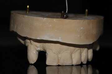 dental technician model removable prosthesis PAPM cobalt chrome resin wax tooth denture frame