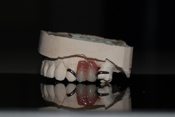 dental technician model removable prosthesis PAPM cobalt chrome resin wax tooth denture frame