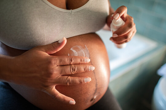 Young woman applying stretch mark cream to pregnant belly at home